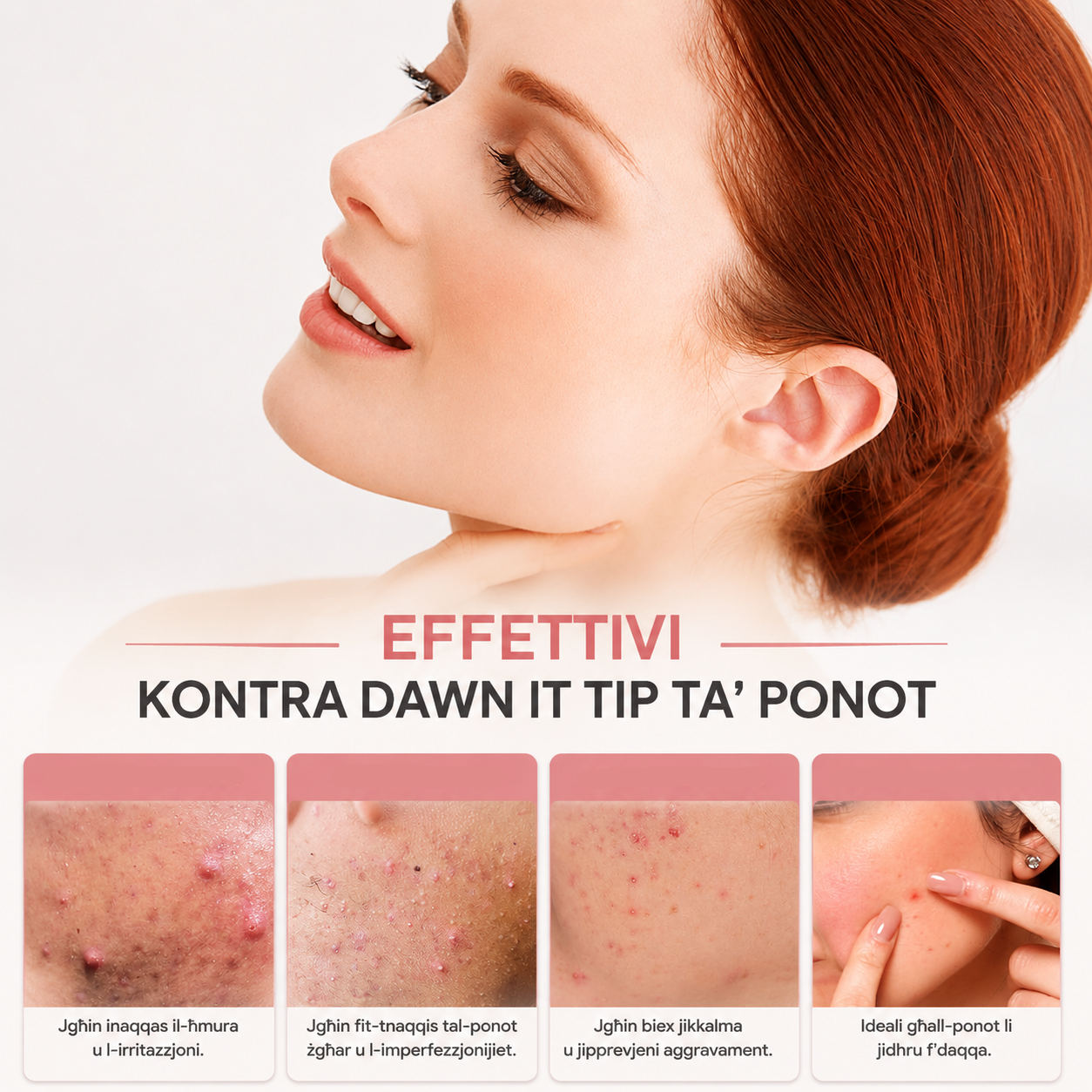 Light On, Acne Off™ - Red Light Acne Patches