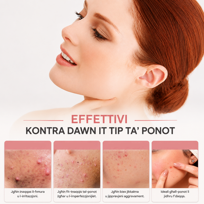 Light On, Acne Off™ - Red Light Acne Patches