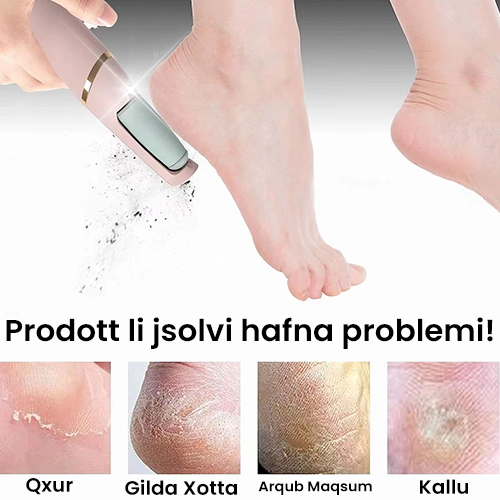 Lunea® Callus Remover (Free Foot Cream Included)