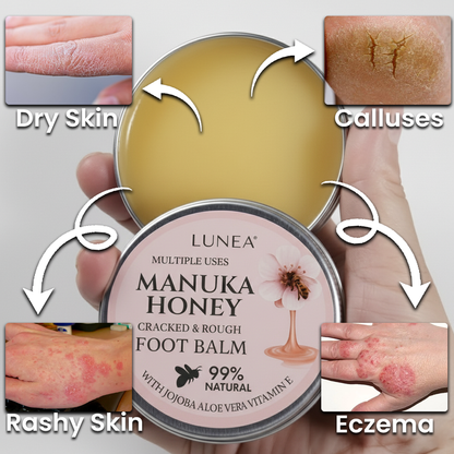 Lunea® Manuka Honey Foot Balm