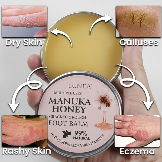 Lunea® Manuka Honey Foot Balm